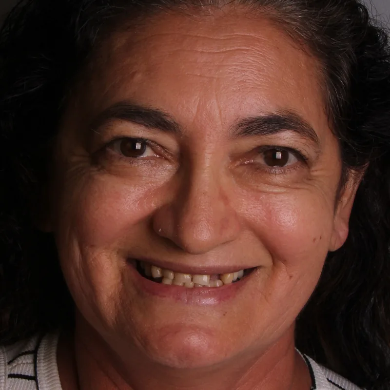 Antes: Maria Neusa sorrindo, com dentes gastos e falhas entre eles